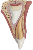 maelketandsidesubluxation