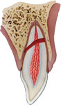 root-fracture4